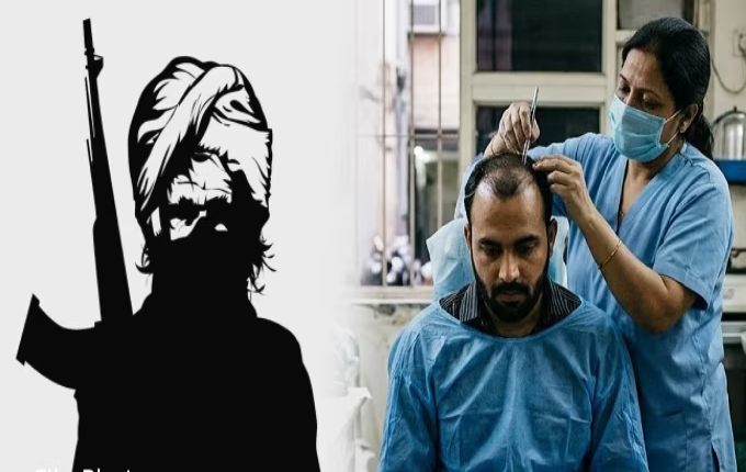 बालों के मोह में मिशन भूला आतंकी! पाकिस्तान से कश्मीर आया, करवाया हेयर ट्रांसप्लांट और फिर पकड़ा गया