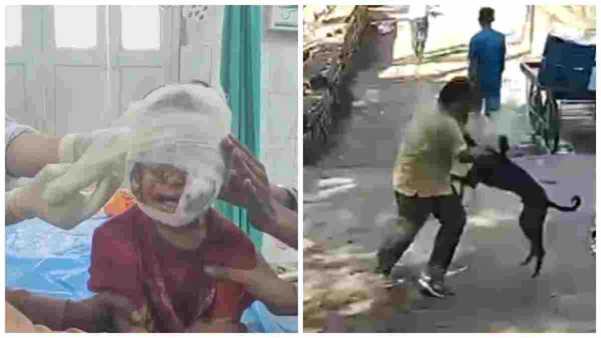 MP में यहां आवारा कुत्तों का आतंक: 3 साल की बच्ची समेत 25 से ज्यादा लोगों पर किया हमला, CCTV में कैद हुई घटना