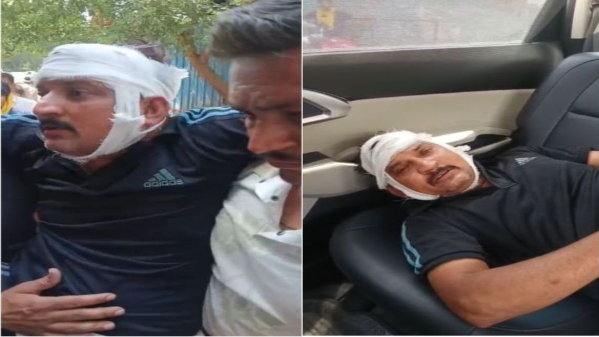 कांग्रेस पार्षद पर जानलेवा हमलाः कट्टे की बट से फोड़ा सिर, दरगाह के पास विवाद शांत कराने पहुंचे थे, आरोपी फिरोज और रईस की तलाश में पुलिस