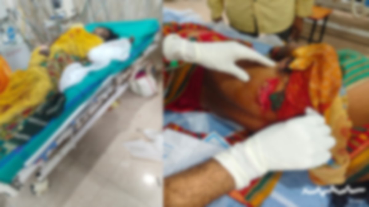 तेंदूपत्ता तोड़ने गई महिलाओं पर जंगली सूअर ने किया हमला, 5 की हालत गंभीर, इलाज जारी