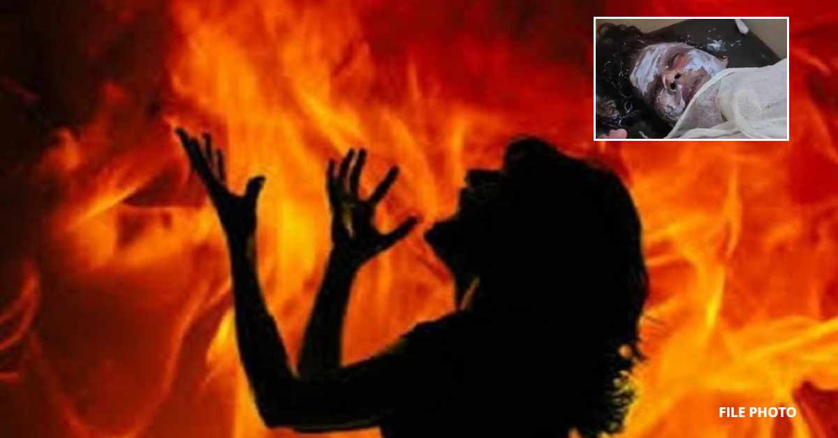 इतनी सी बात और… भाईयों ने महिला को जिंदा जलाने का किया प्रयास, हालत गंभीर
