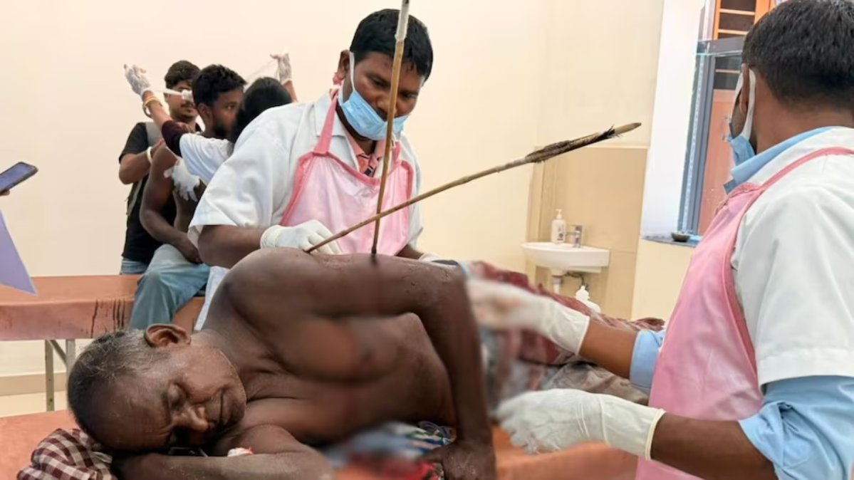 जमीन विवाद में नुकीले तीरों की हुई बौछार, पीड़ित के हाथ में कई तीर हाथ में धंसे, हालत नाजुक