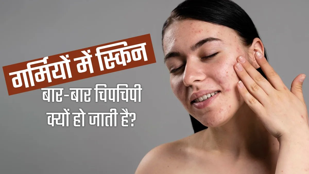 गर्मियों में क्यों चिपचिपी हो जाती है त्वचा, जानिए इसके कारण और बचाव के आसान तरीके …