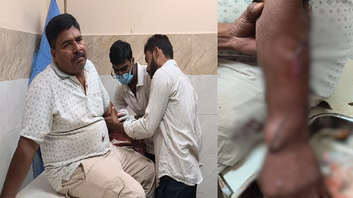 पिस्तौल की नोक पर युवक से सोने की चैन, पैसे और मोबाइल की लूट, विरोध करने पर चाकू से किया हमला