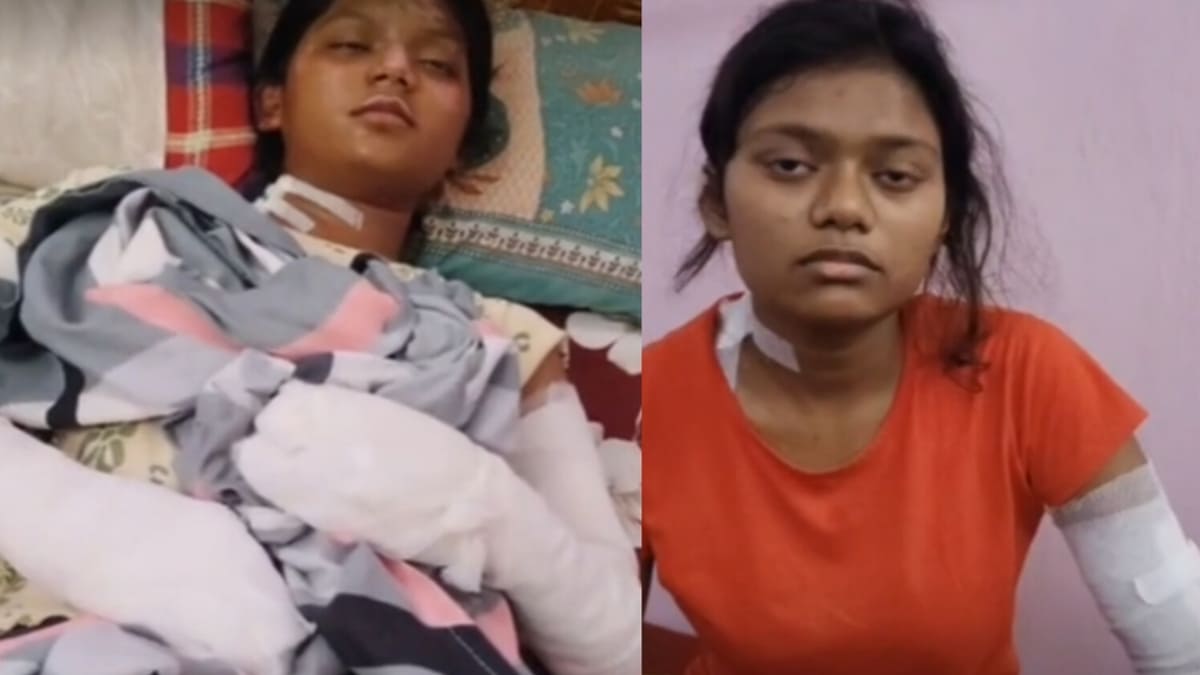 दानापुर में खाना बनाते समय सिलेंडर रिसाव से लगी भीषण आग, महिला की मौत, दो बेटियां गंभीर
