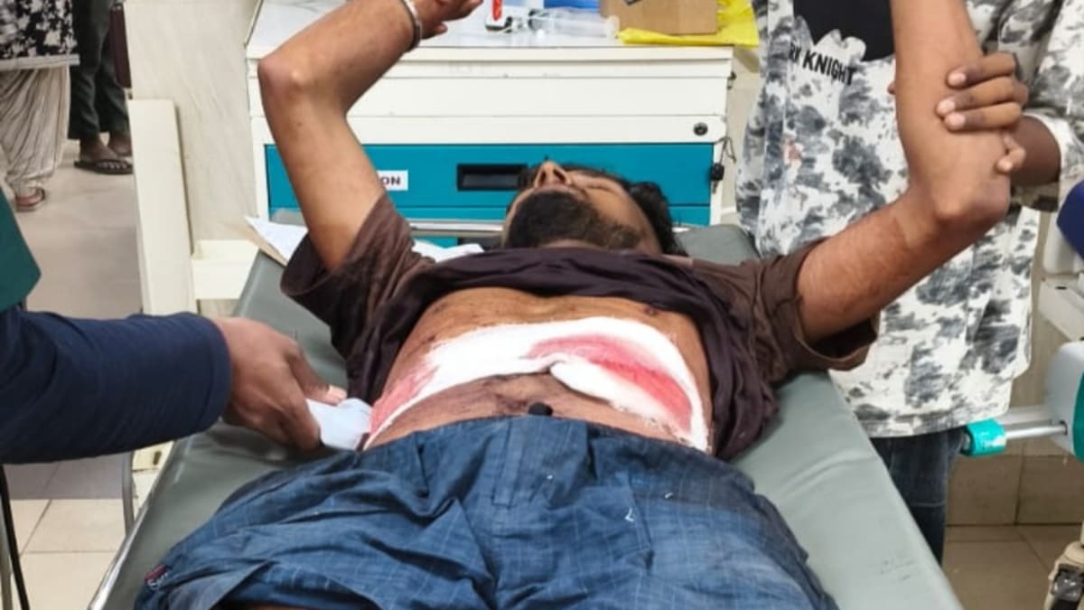 भोपाल से इंजीनियरिंग पढ़कर घर लौटा छात्र पुरानी रंजिश का शिकार, चाकू से ताबड़तोड़ हमले में हालत गंभीर