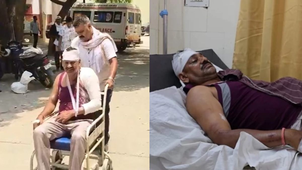 यूपी में छत्तीसगढ़ पुलिस टीम पर हमला : सिविल ड्रेस में वांटेड आरोपी को पकड़ने गई थी टीम, चोर समझकर ग्रामीणों ने पीटा, आरक्षक गंभीर