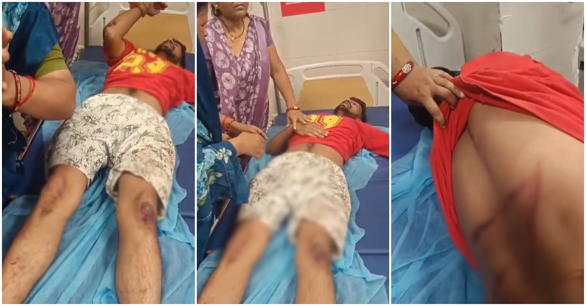 मुरैना विधायक के बेटे से मारपीट, चार युवकों पर FIR दर्ज, परिजनों ने लगाया एकतरफा कार्रवाई का आरोप