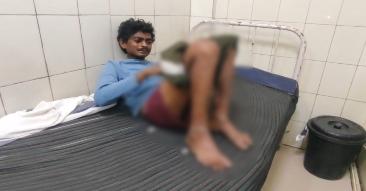 घरेलू हिंसा की रूह कंपा देने वाली वारदात! पति के गुप्तांग पर उड़ेला खौलता पानी, ससुर भी झुलसे