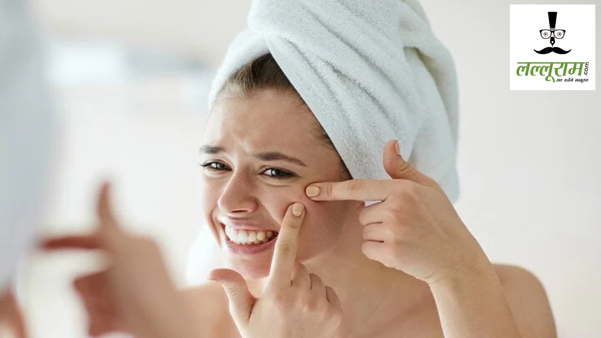 How To Remove Pimples : भूलकर भी न करें पिंपल्स के लिए ये वायरल नुस्खा ट्राय! नहीं तो चेहरा हो सकता है खराब