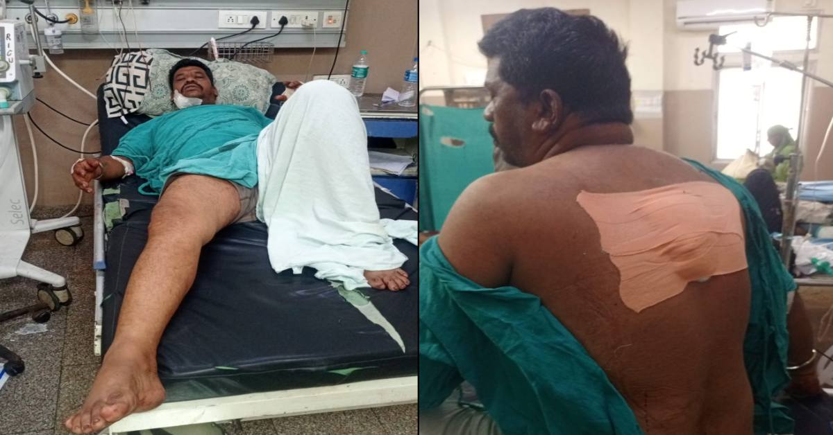 इंदौर में रिश्तों का खून! बेटी ने बॉयफ्रेंड के साथ मिलकर पिता पर किया चाकू से हमला, अस्पताल में भर्ती