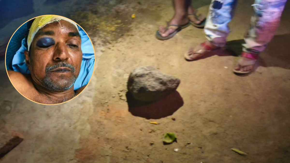 खुले आसमान के नीचे मंडराई मौत: खाट पर सो रहे दादा-पोती पर हमला, सिर पर पत्थर मारकर भागे बदमाश