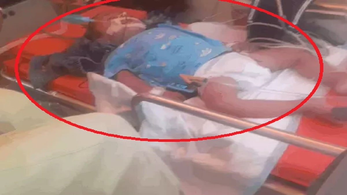 गलत इंजेक्शन से डेढ़ साल के बच्चे की मौत: झोलाछाप डॉक्टर के खिलाफ गैर-इरादतन हत्या का केस दर्ज; आरोपी क्लिनिक संचालक फरार