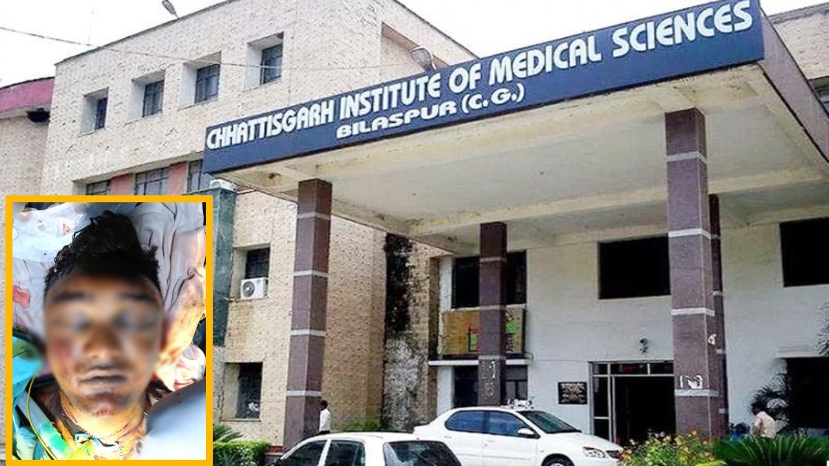 सिम्स के डॉक्टरों ने किया कमाल : गले की कटी श्वासनली की आपातकालीन सर्जरी कर युवक को दिया नया जीवन