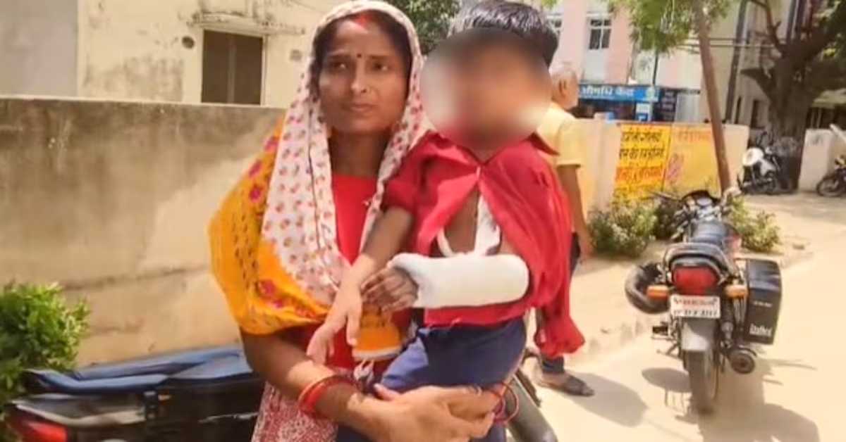 UP में इलाज के नाम पर मजाक चल रहा! बच्ची का टूटा था दाएं हाथ, बाएं हाथ में बांध दिया प्लास्टर, भगवान भरोसे सरकारी अस्पताल
