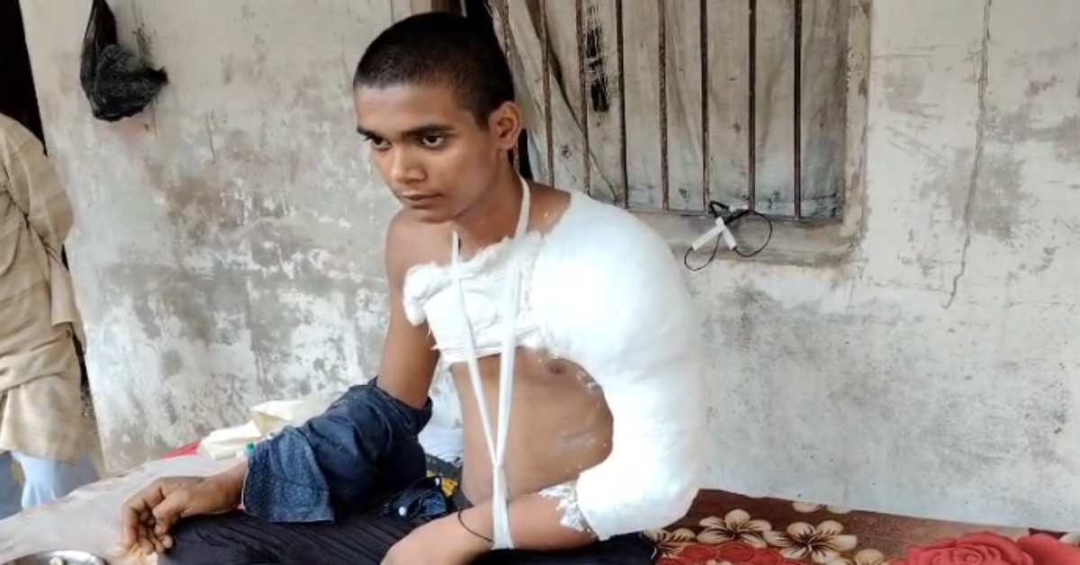 योगी जी…ये है आपका जीरो टॉलरेंस! बिना कोई कारण बताए पुलिस वालों ने नाबालिग की पिटाई कर तोड़ा हाथ, खाकी वाले ‘गुंडों’ पर कब लगेगी लगाम?