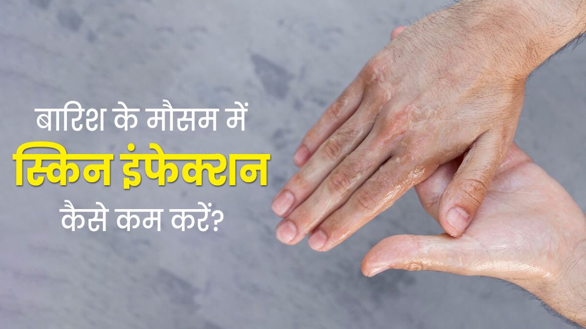 मानसून में स्किन इंफेक्शन से रहना है सुरक्षित? अपनाएं सही स्किनकेयर रूटीन, नहीं होगी खुजली, रैशेज और फंगल संक्रमण की परेशानी …