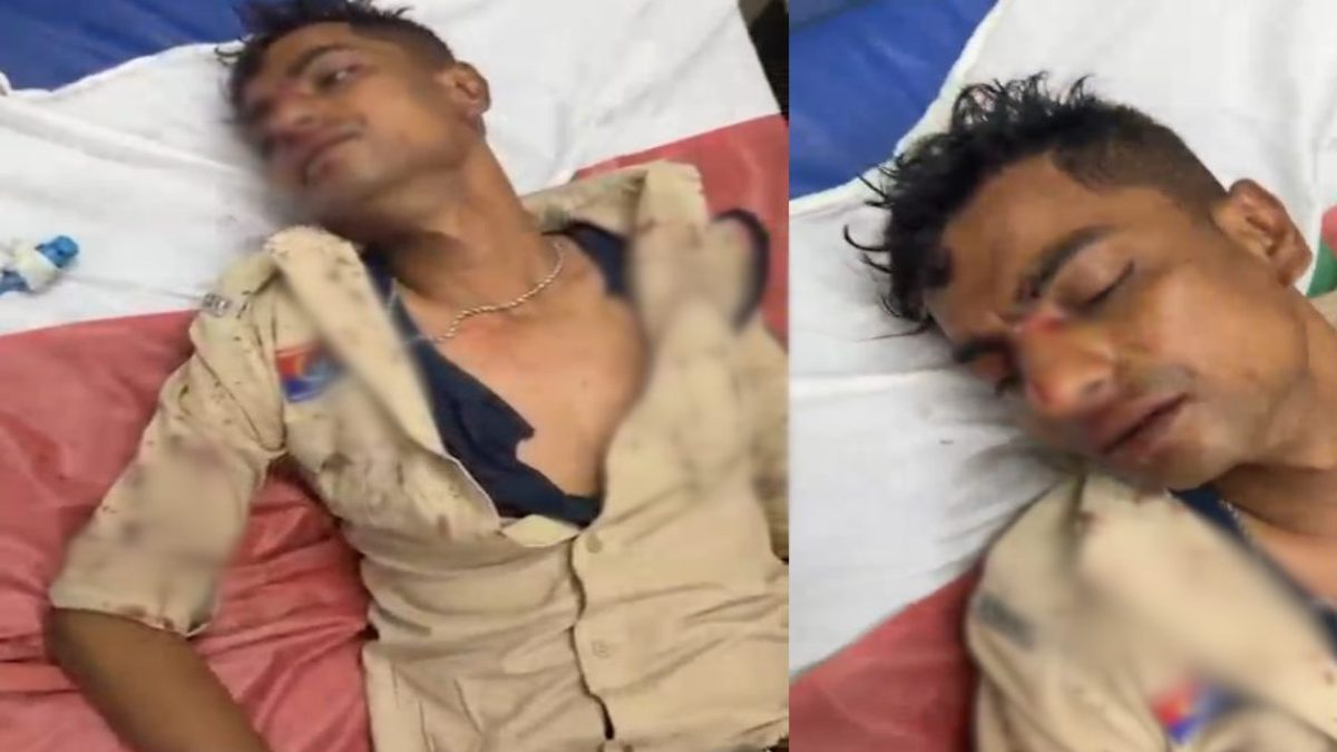 CG News : डायल-112 के आरक्षक पर हमला, शराब के नशे में सिरफिरे ने डंडे से वार कर किया घायल