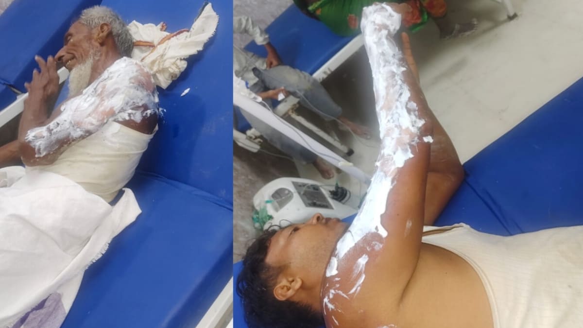 शॉर्ट सर्किट से घर में लगी भीषण आग, सिलेंडर ब्लास्ट में 5 लोग झुलसे