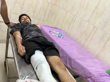 पुलिसकर्मी को दांत से काटा, फिर भागा, अब कुख्यात बदमाश का ऐसा हाल!