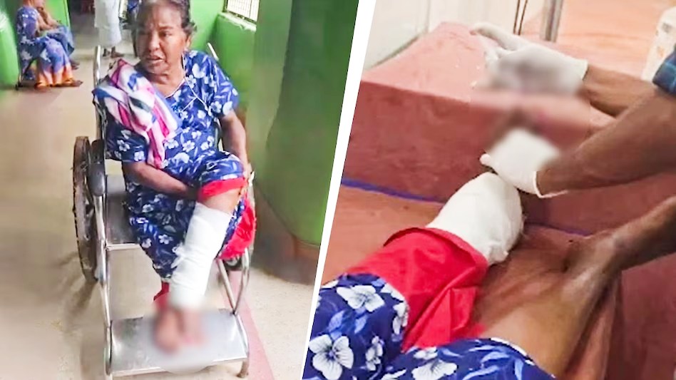 इलाज कराने गई थी बुजुर्ग महिला, सरकारी अस्पताल में चूहे ने कुतर दिया पैर का अंगूठा