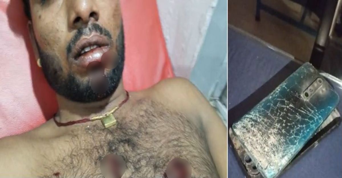 वीडियो बनाते समय मोबाइल में हुआ जोरदार ब्लास्टः युवक के मुंह और सीने में गंभीर चोटें, अस्पताल में भर्ती