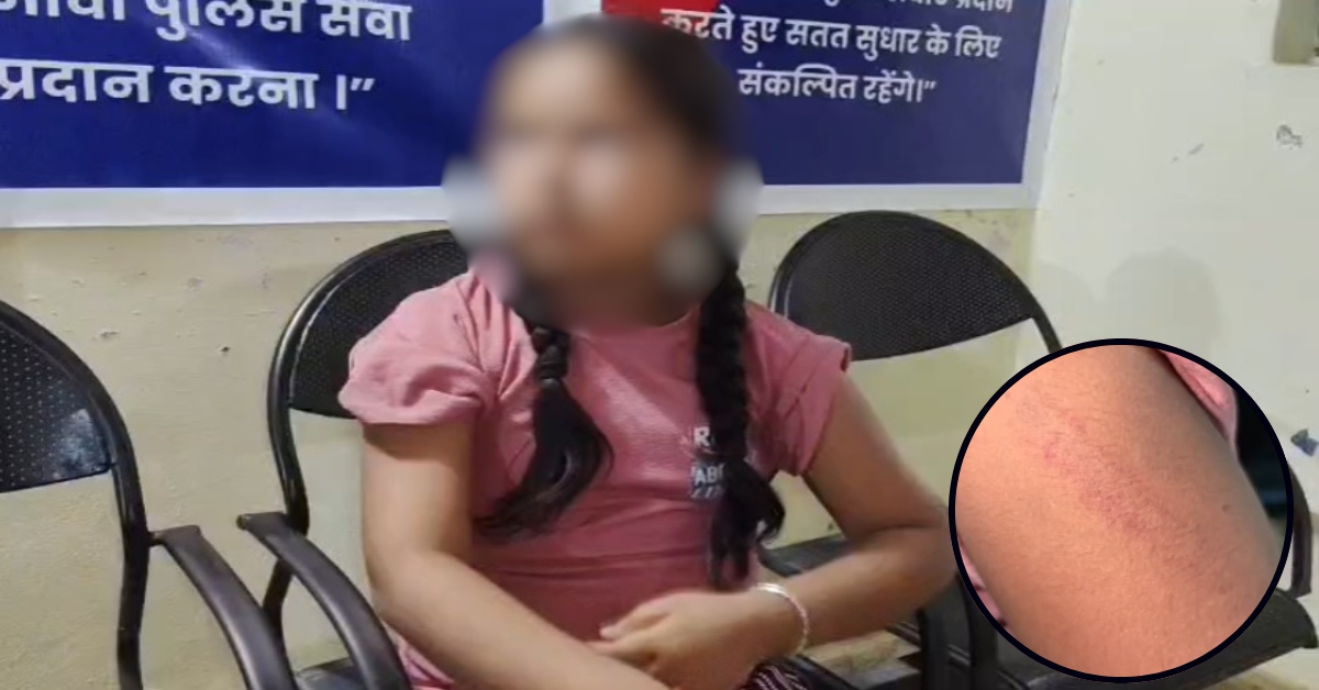 हेडमास्टर की हैवानियत! वैन में जगह नहीं छोड़ी तो 7वीं की छात्रा को डंडों से पीटा, मासूम को लेकर थाने पहुंचे परिजन