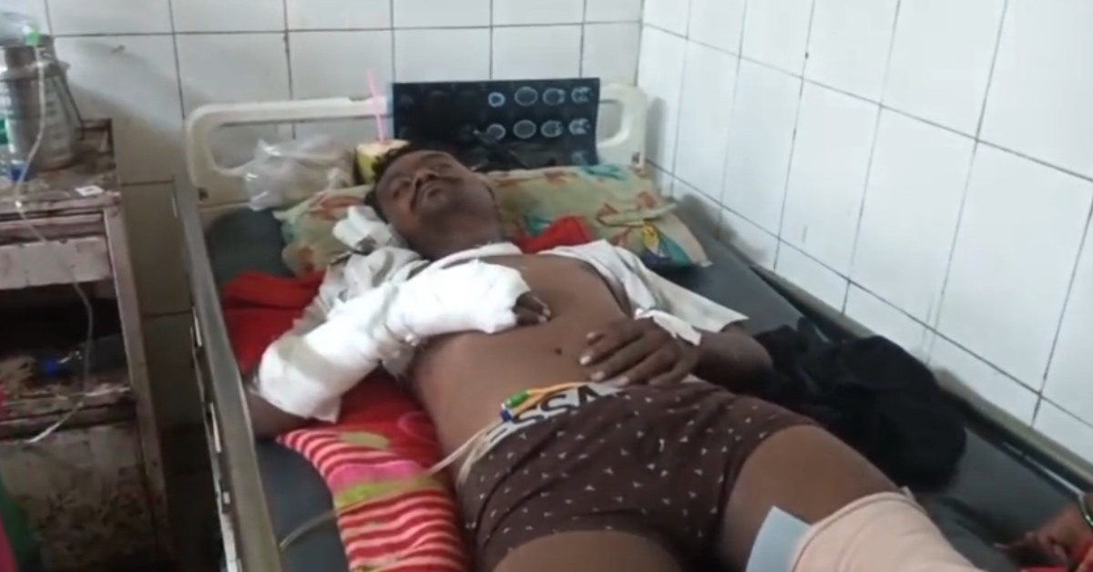 गिरफ्तारी के दौरान छत से गिरा… पुलिस बोली- खुद कूदा, आरोपी ने कहा- धक्का दिया