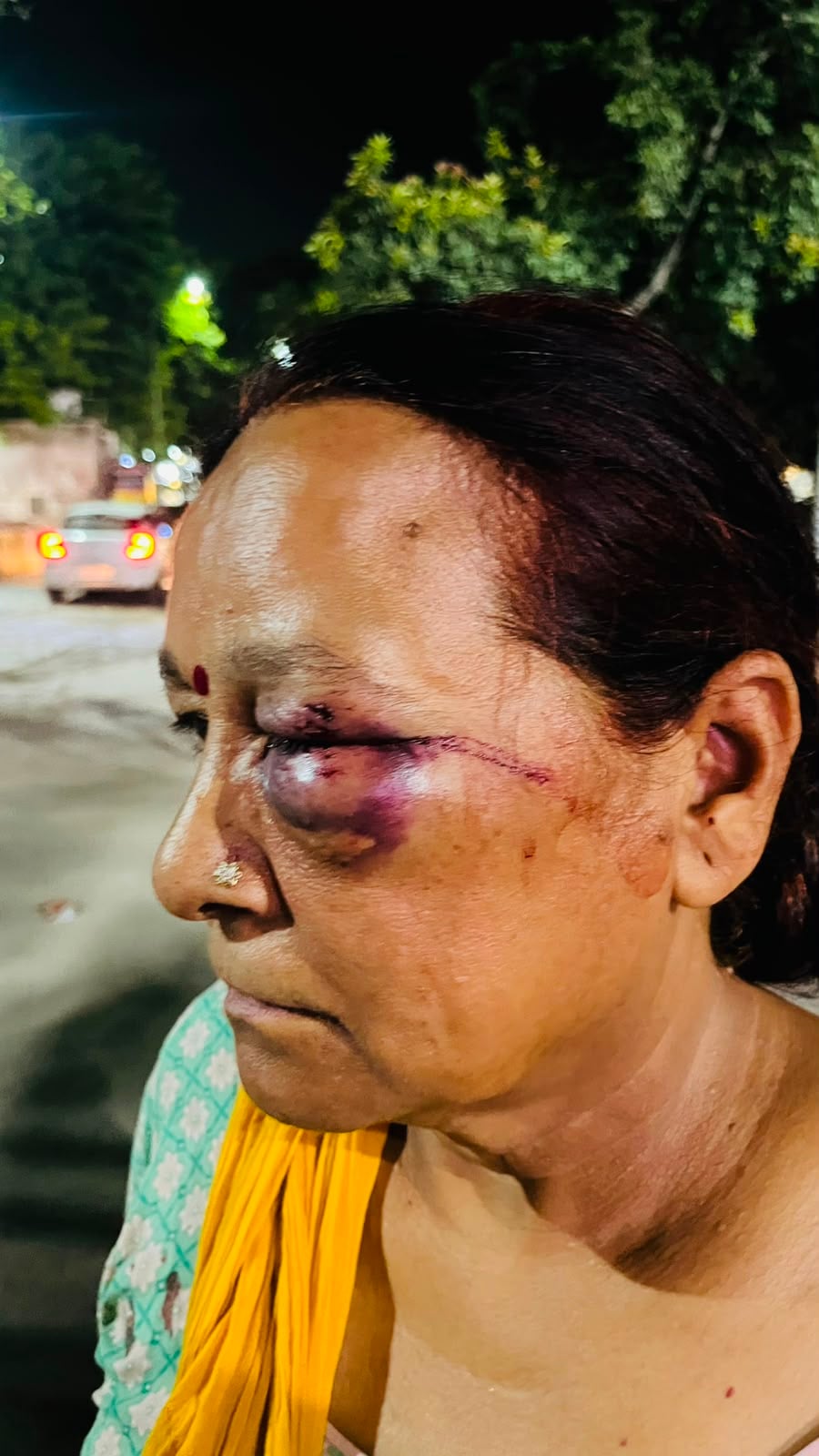 क्रिप्टो निवेश के ₹8 लाख के विवाद में महिला के घर पर जानलेवा हमला, आंख गंभीर घायल; सोनीपत में FIR दर्ज