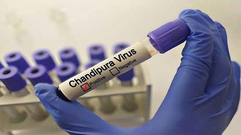 Chandipura Virus: राजस्थान में दो मासूमों की मौत, स्वास्थ्य विभाग अलर्ट, जानिए लक्षण और बचाव