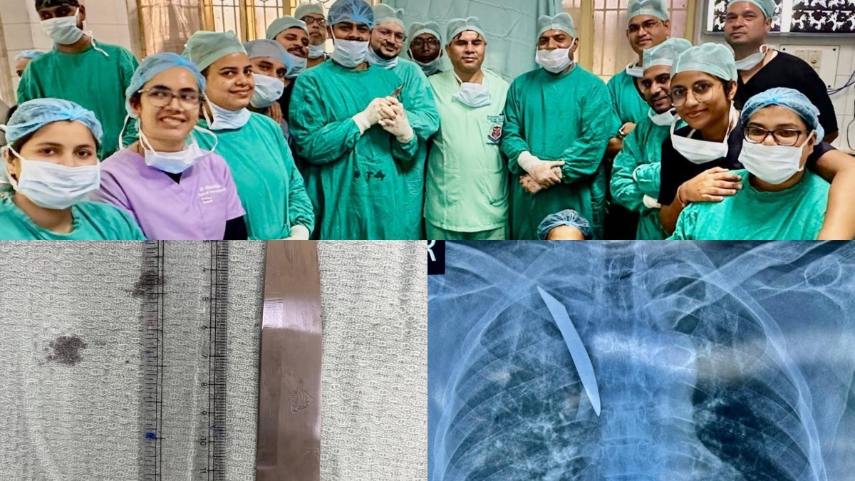 छाती में धंसा था चाकू, 3 घंटे की जंग के बाद मौत को दी मात, KGMU के डॉक्टरों का चमत्कार!