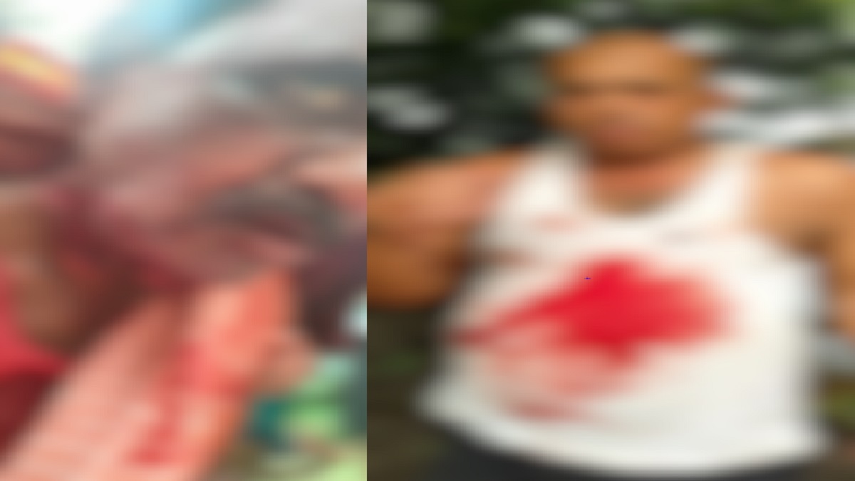 मोतिहारी में दिनदहाड़े खूनी हमला, धारदार हथियार से दो लोगों को किया लहूलुहान