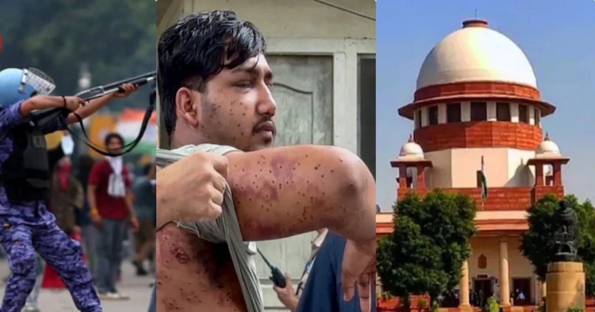 पैलेट गन के इस्तेमाल पर अभी रोक नहीं, SC ने कहा- घायल लोगों का सही इलाज कराया जाए