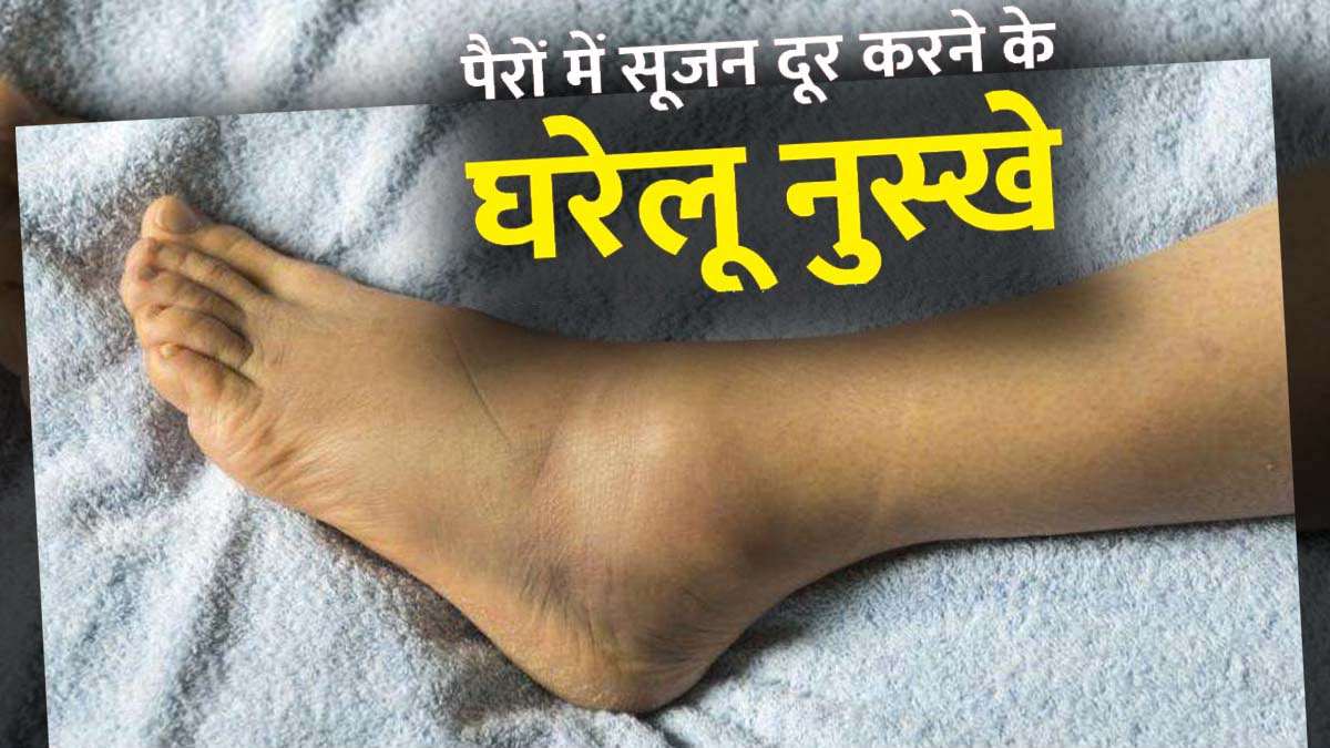 पैरों में रहती है सूजन और दर्द, तो अपनाएं ये 5 आसान आदतें, मिल सकती है राहत …