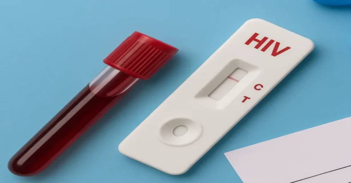 मंत्री ब्रजेश पाठक और उनका सिस्टम सो रहा! तेजी से बढ़ रहे HIV के मामले, 3 महीने में 4 गुना बढ़े नए मरीज, लोगों की मौत के बाद जागेंगे जिम्मेदार?