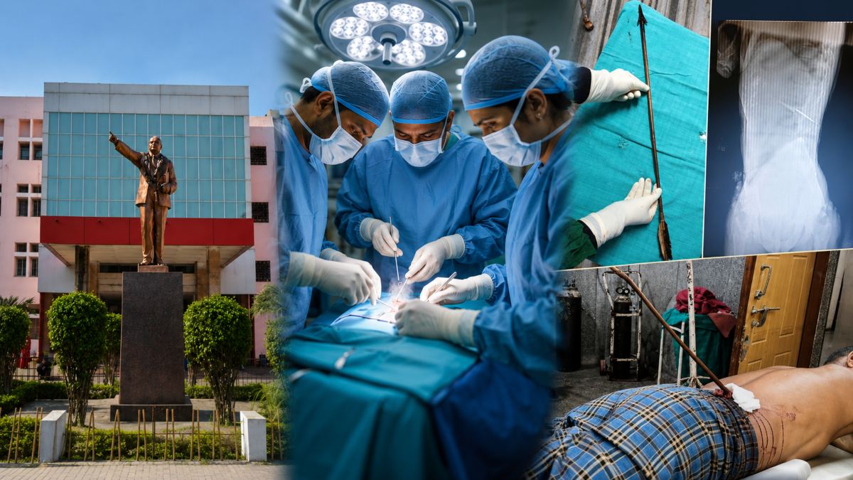 मेकाहारा के डॉक्टरों ने किया कमाल: पीठ में धंसे तीर से गंभीर रूप से घायल मरीज का सफल ऑपरेशन, बचाई जान