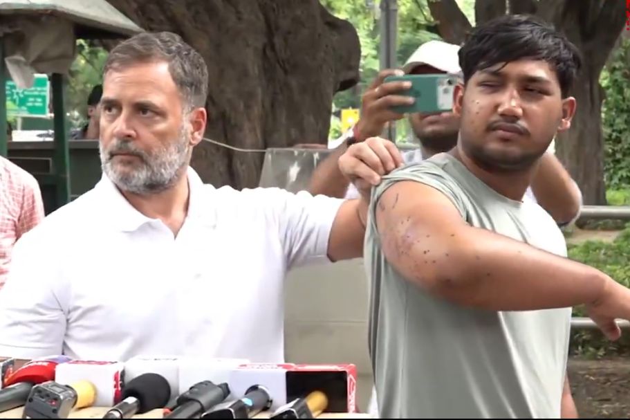 पैलेट गन से अंधे हो चुके छात्र को लेकर आये राहुल गांधी, कहा- धर्मेंद्र प्रधान एक ‘अपराधी शिक्षामंत्री’, इस्तीफा देना चाहिए