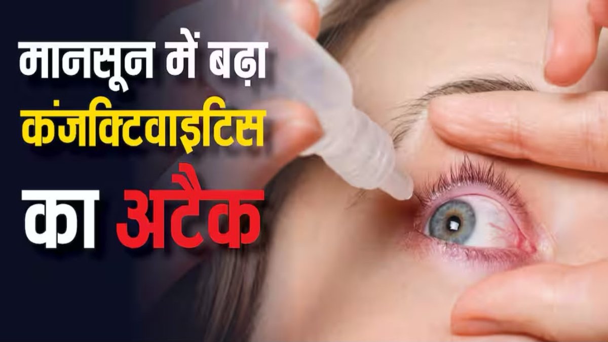 मानसून में तेजी से बढ़ रहा है Eye Flu का खतरा, जानिए Conjunctivitis के लक्षण और बचाव के तरीके