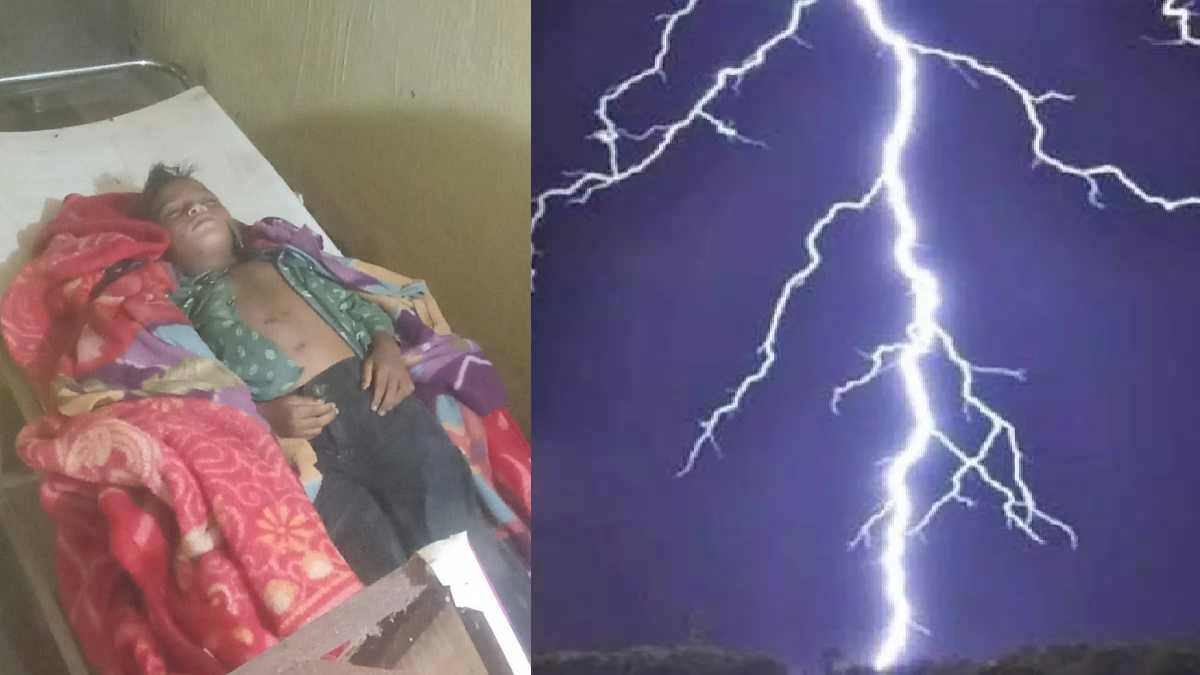 CG News : आकाशीय बिजली गिरने से दो बच्चों की मौत, दो सगे भाइयों का अस्पताल में इलाज जारी
