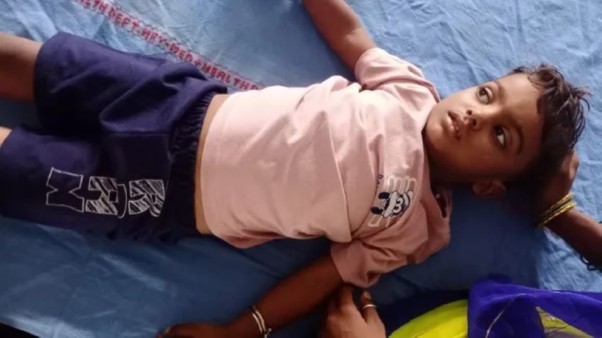 जींद में साढ़े तीन साल के मासूम ने निगला 5 रुपये का सिक्का, डॉक्टरों ने दूरबीन से बचाई जान