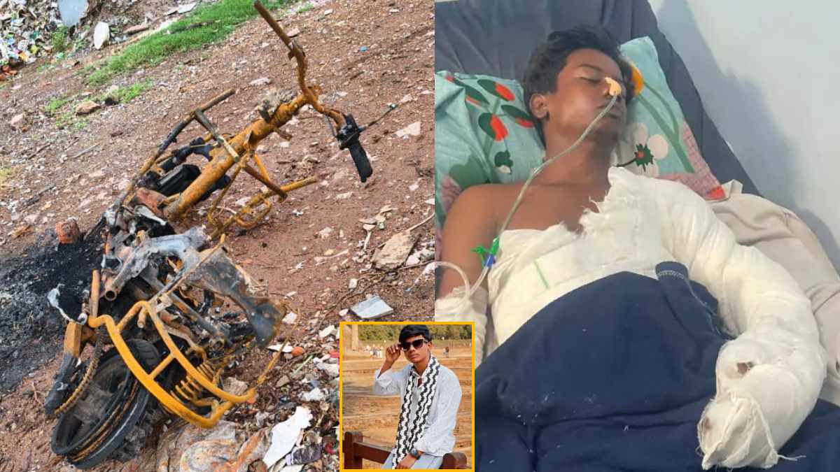 शराब पार्टी के बहाने ले गए, फिर आग में झुलसा! घायल युवक ने इलाज के दौरान 7 दिन बाद तोड़ा दम, दोस्तों पर हत्या का आरोप