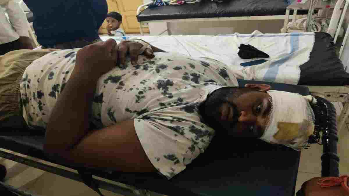 जानलेवा रास्ता: BJP जिला उपाध्यक्ष ने पार्षद के साथ मिलकर युवक पर फावड़े से किया हमला, पुलिस ने FIR में नहीं लिखा नाम
