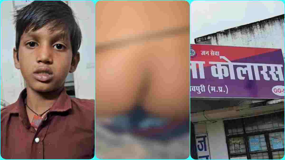 शिक्षक की बोतल से पानी पीना छात्र को पड़ा महंगा, जमकर हुई पिटाई, जातिसूचक शब्द का भी आरोप