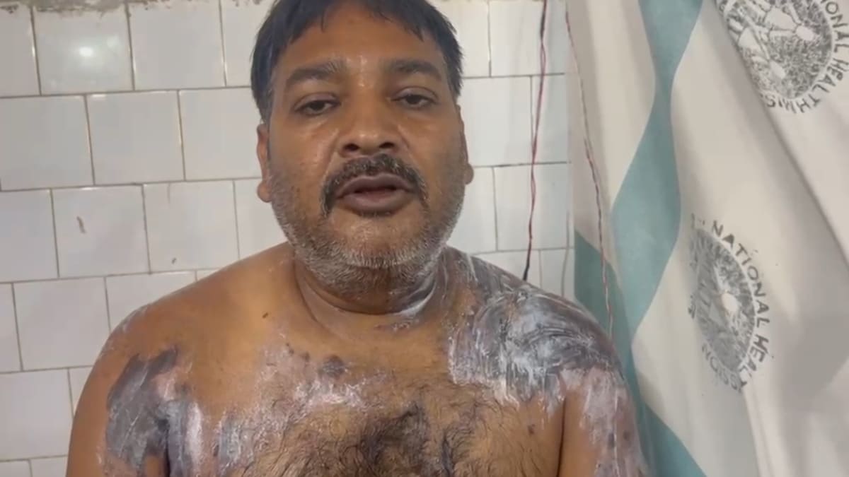 मोतिहारी में तेजाब हमले से सोने के कारोबारी का परिवार झुलसा, ढाई साल का मासूम कैथेटर पर