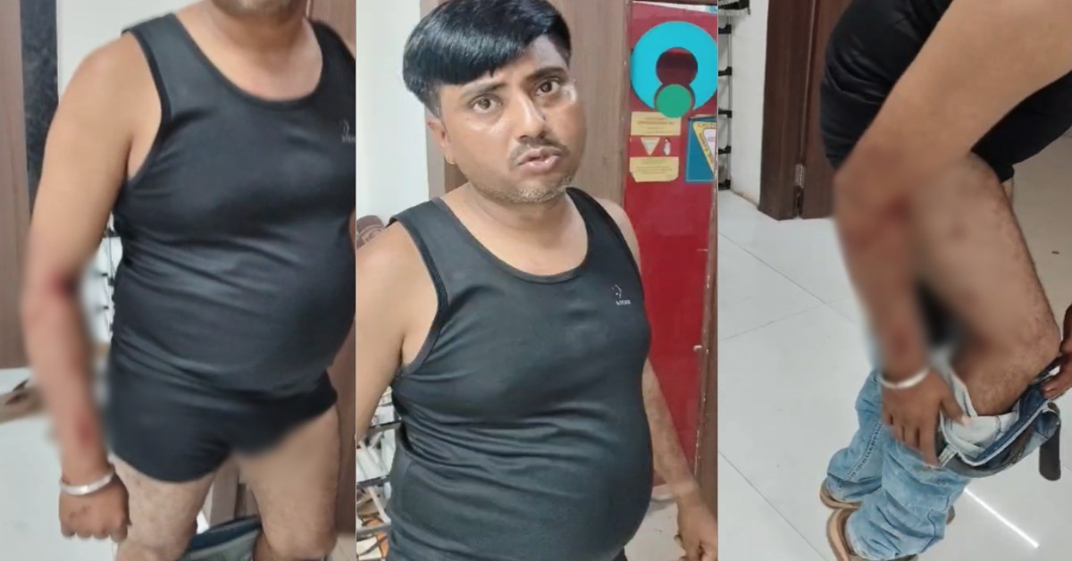 बिजली कर्मचारियों पर छोड़े कुत्ते, घायल करने के बाद तानी बंदूक; मोहल्ले में दोबारा दिखने पर गोली मारने की धमकी