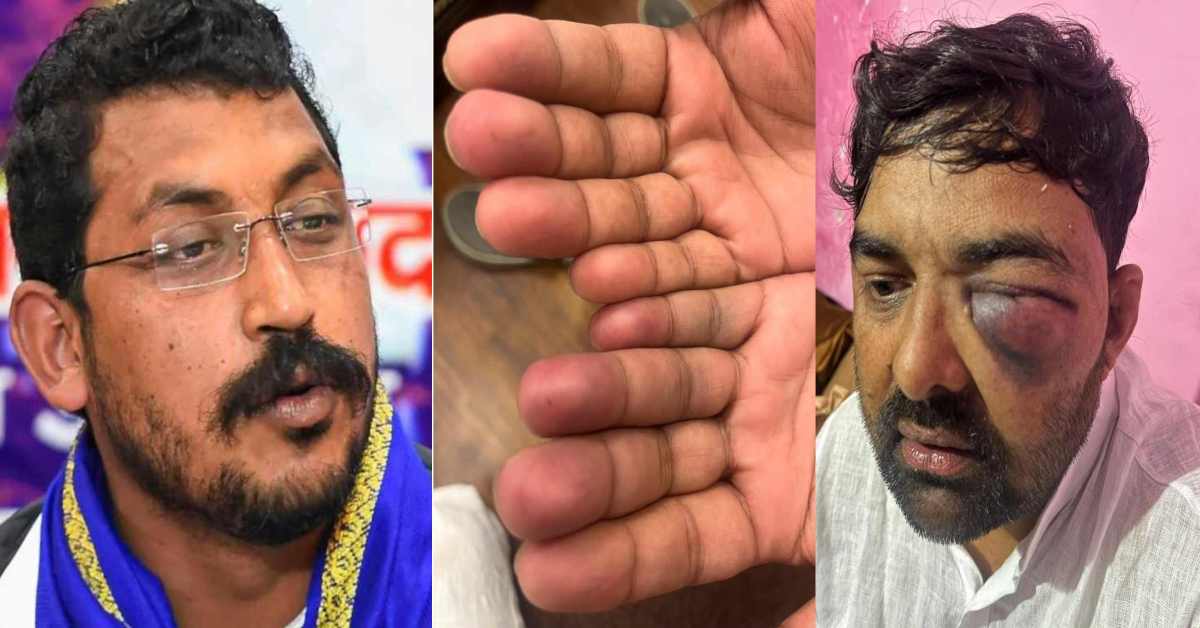योगी आदित्यनाथ जी! यह पुलिसिंग नहीं, बल्कि…किसान नेता और जाटव नेता की पिटाई पर भड़के सांसद, कानून पर सवाल खड़ा करते हुए कर दी बड़ी मांग