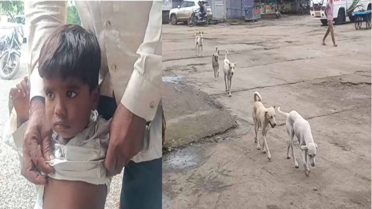 आवारा कुत्तों का आतंकः घर के बाहर खेल रहे 3 साल के मासूम को बनाया शिकार, अस्पताल में भर्ती, ग्रामीणों में रोष