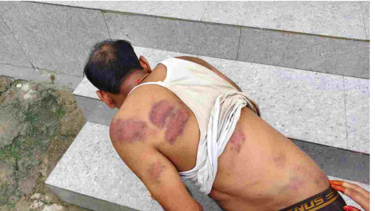 भिंड में सहायक सचिव की किडनैपिंग: 5 लाख के लेनदेन को लेकर 13 घंटे बनाया बंधक, पीट-पीटकर उधेड़ी चमड़ी