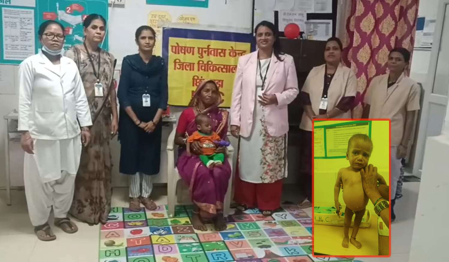 कुपोषण से कराहता बचपन! मां का साया उठा तो 1 साल के पोते को बचाने सिस्टम से भिड़ गई अनपढ़ दादी