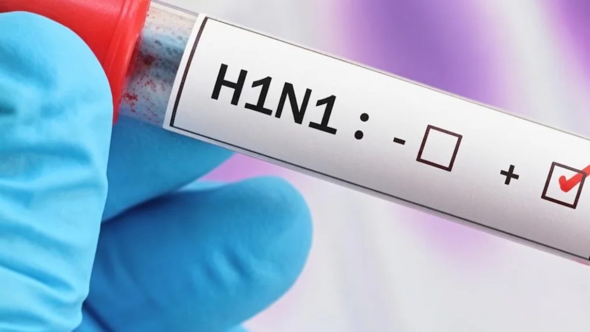 Delhi Swine Flu: दिल्ली में स्वाइन फ्लू से एक और मौत, H1N1 से पीड़ित बुजुर्ग ने तोड़ा दम, निमोनिया भी हो गया था